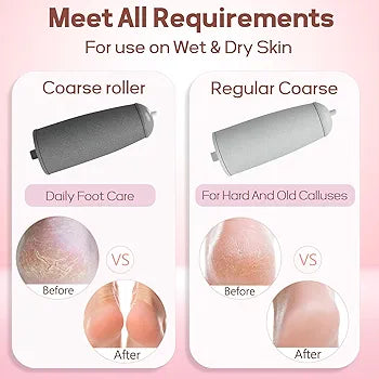 Electronic Cordless Pedicure Callus Dead Skin Remover Polishing Tool