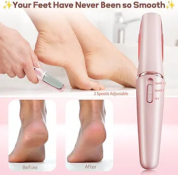 Electronic Cordless Pedicure Callus Dead Skin Remover Polishing Tool